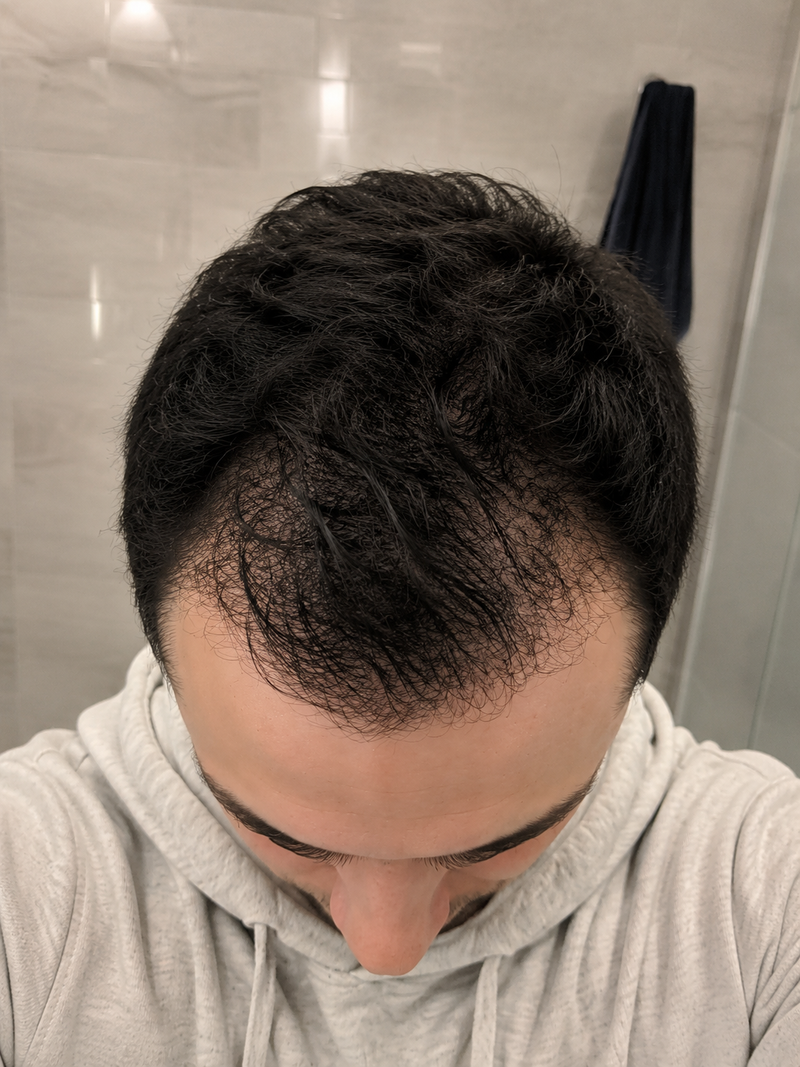 Week 4
