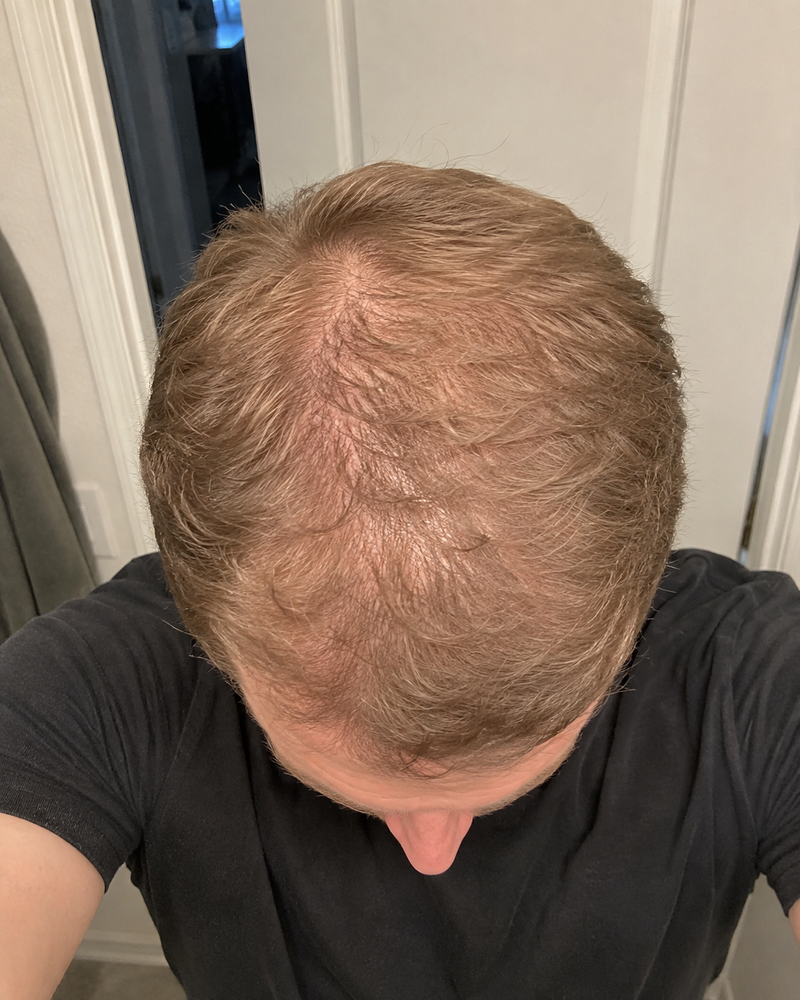 Day 0